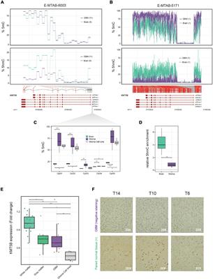 Epigenetic Deregulation of the Histone Methyltransferase KMT5B Contributes to Malignant Transformation in Glioblastoma